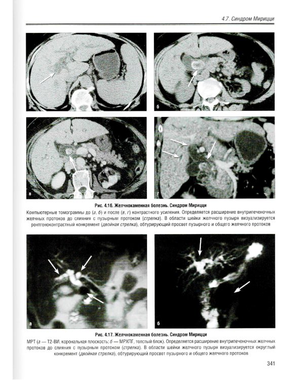 Визуализация заболеваний печени и желчевыводящих путей: Учебное пособие