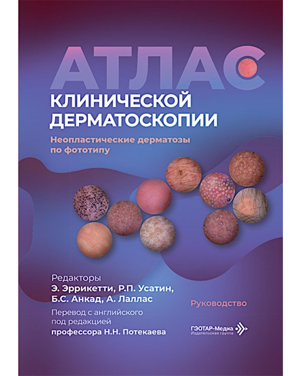 Дополнительное изображение книги «Атлас клинической дерматоскопии. Ненеопластические дерматозы по фототипу: руководство»