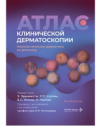 Атлас клинической дерматоскопии. Ненеопластические дерматозы по фототипу: руководство