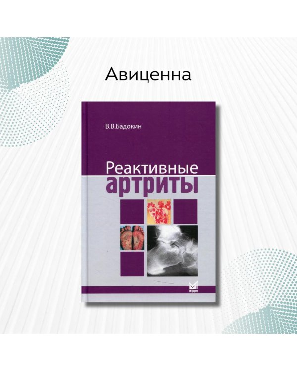 Реактивные артриты