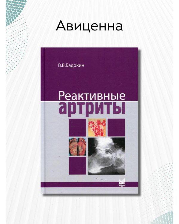 Реактивные артриты