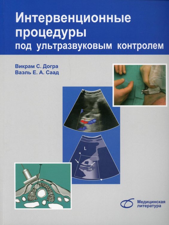 Интервенционные процедуры под ультразвуковым контролем Интервенционные процедуры под ультразвуковым контролем