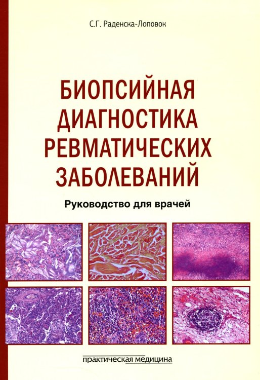 Биопсийная диагностика ревматических заболеваний. Руководство для врачей Биопсийная диагностика ревматических заболеваний. Руководство для врачей