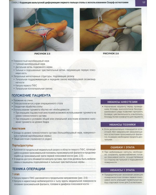 Хирургия голеностопного сустава и стопы. Оперативная техника. В 2 ч (комплект из 2-х книг)