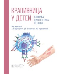 Крапивница у детей: клиника, диагностика, лечение