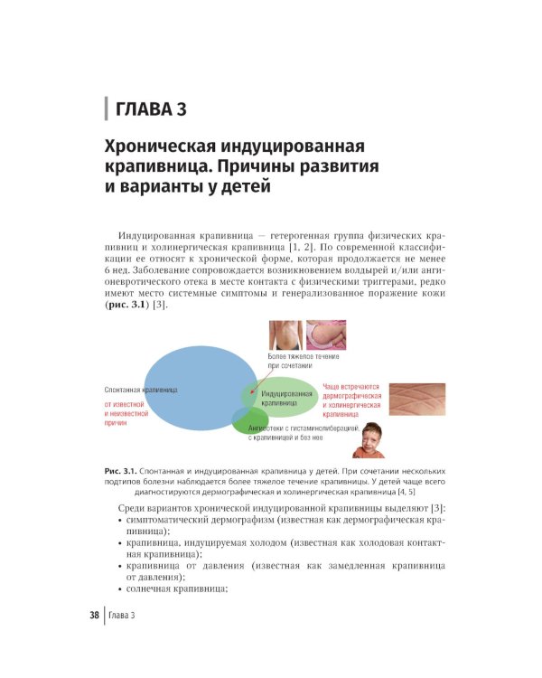Крапивница у детей: клиника, диагностика, лечение