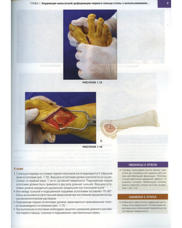 Хирургия голеностопного сустава и стопы. Оперативная техника. В 2 ч (комплект из 2-х книг)