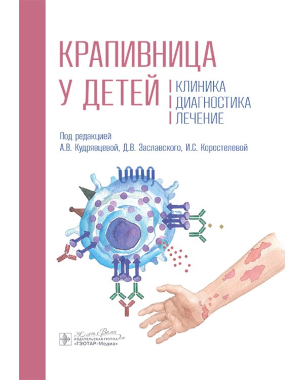 Крапивница у детей: клиника, диагностика, лечение