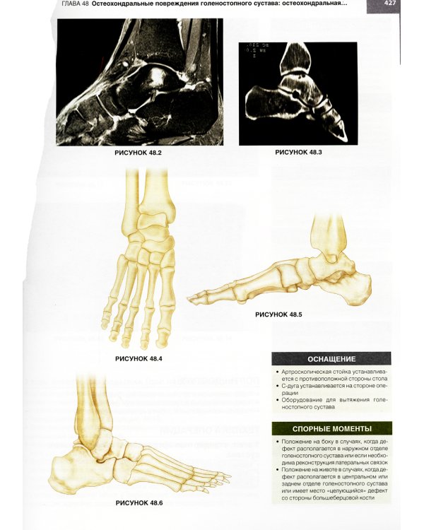 Хирургия голеностопного сустава и стопы. Оперативная техника. В 2 ч (комплект из 2-х книг)
