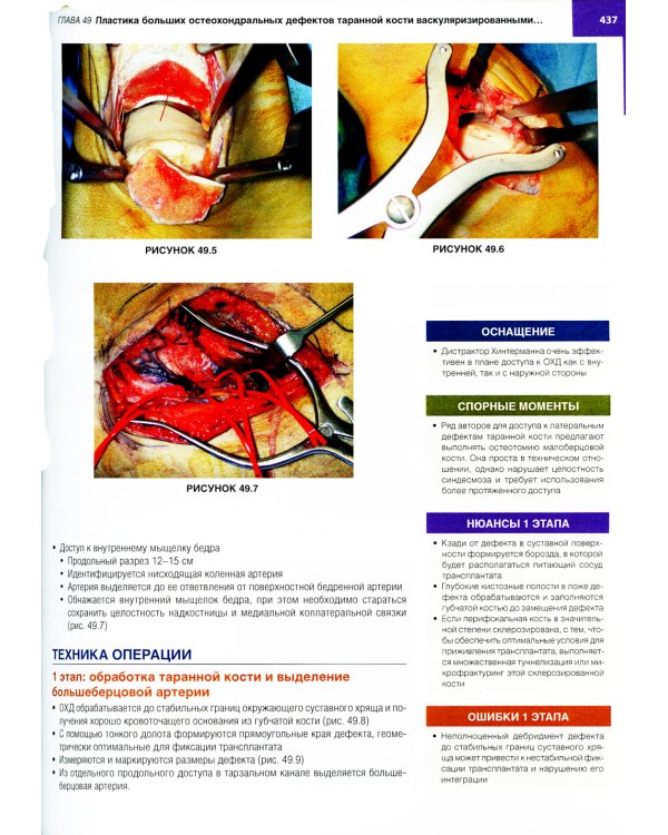 Хирургия голеностопного сустава и стопы. Оперативная техника. В 2 ч (комплект из 2-х книг)