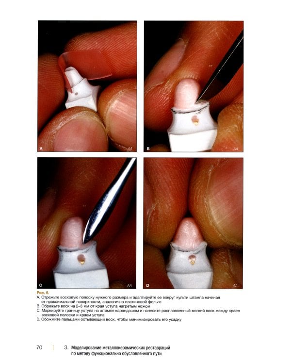 Металлокерамические реставрации.Теория и практика. Рабочая тетрадь зубного техника