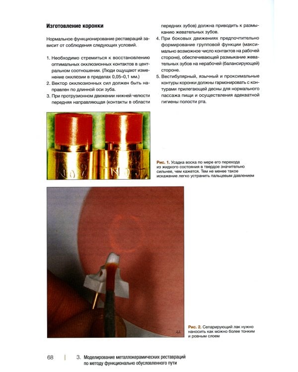 Металлокерамические реставрации.Теория и практика. Рабочая тетрадь зубного техника