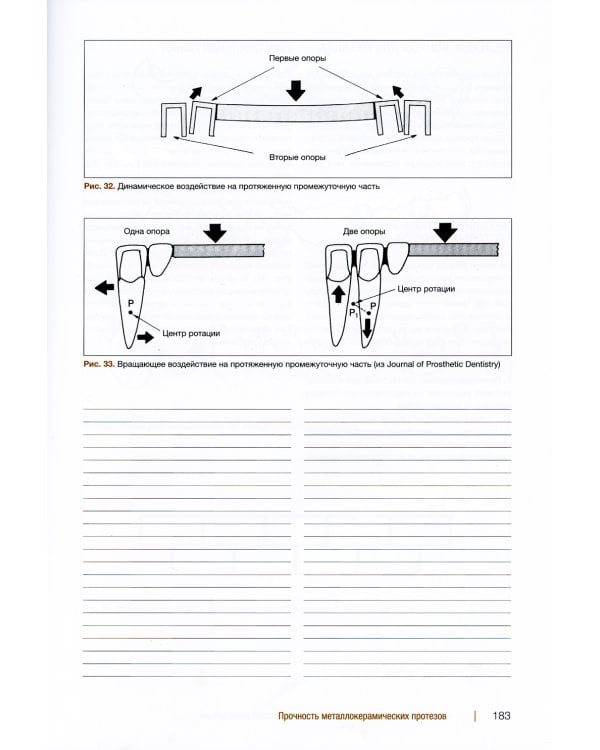 Металлокерамические реставрации.Теория и практика. Рабочая тетрадь зубного техника