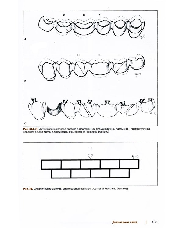 Металлокерамические реставрации.Теория и практика. Рабочая тетрадь зубного техника
