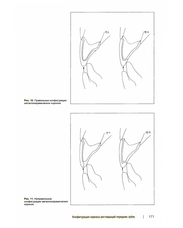 Металлокерамические реставрации.Теория и практика. Рабочая тетрадь зубного техника