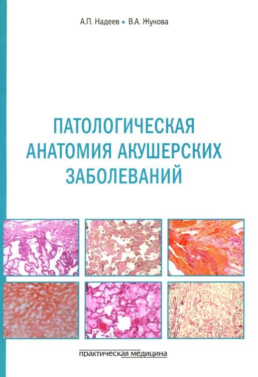 Патологическая анатомия акушерских заболеваний Патологическая анатомия акушерских заболеваний