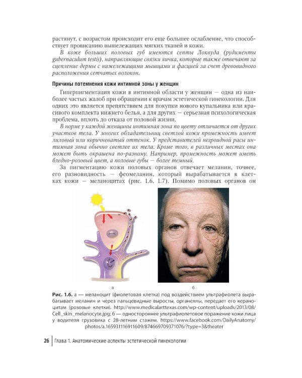 Эстетическая гинекология