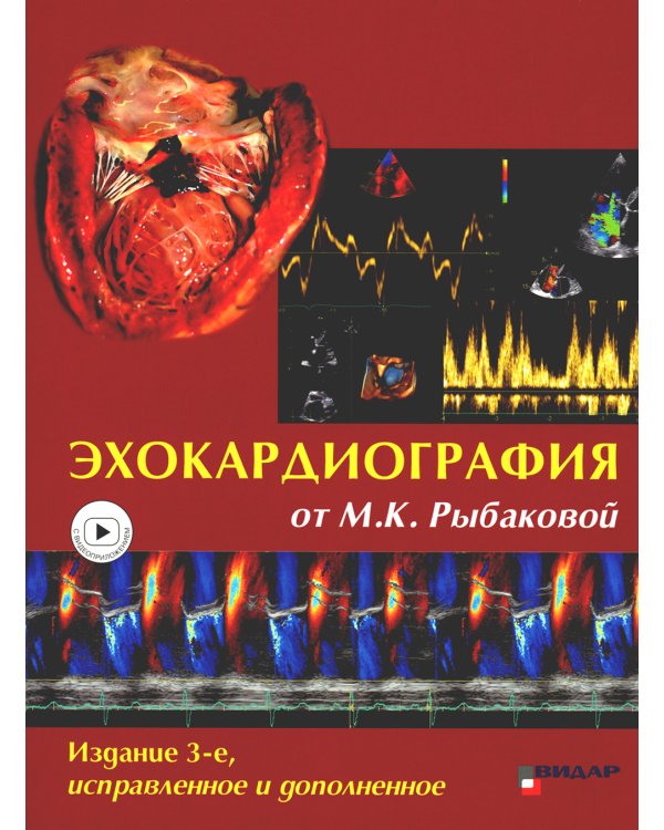 Эхокардиография от М.К. Рыбаковой: Руководство: с приложением. 3-е изд., испр.и доп (ссылка на видеоматериалы)
