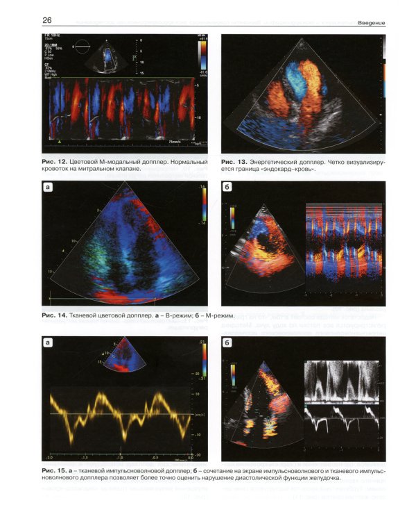Эхокардиография от М.К. Рыбаковой: Руководство: с приложением. 3-е изд., испр.и доп (ссылка на видеоматериалы)