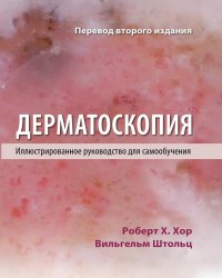 Дерматоскопия. Иллюстрированное руководство для самообучения