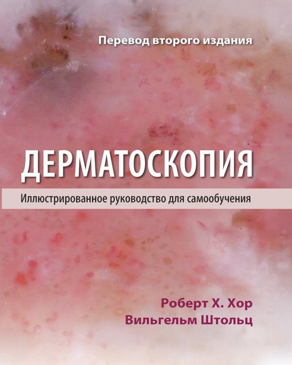 Дерматоскопия. Иллюстрированное руководство для самообучения