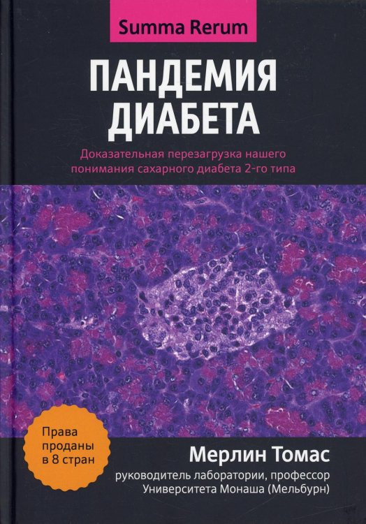 Summa rerum Пандемия диабета: доказательная перезагрузка нашего понимания сахарного диабета 2-го типа