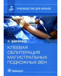 Клеевая облитерация магистральных подкожных вен: руководство для врачей