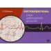 Электрокардиограмма: основы дифференциальной диагностики