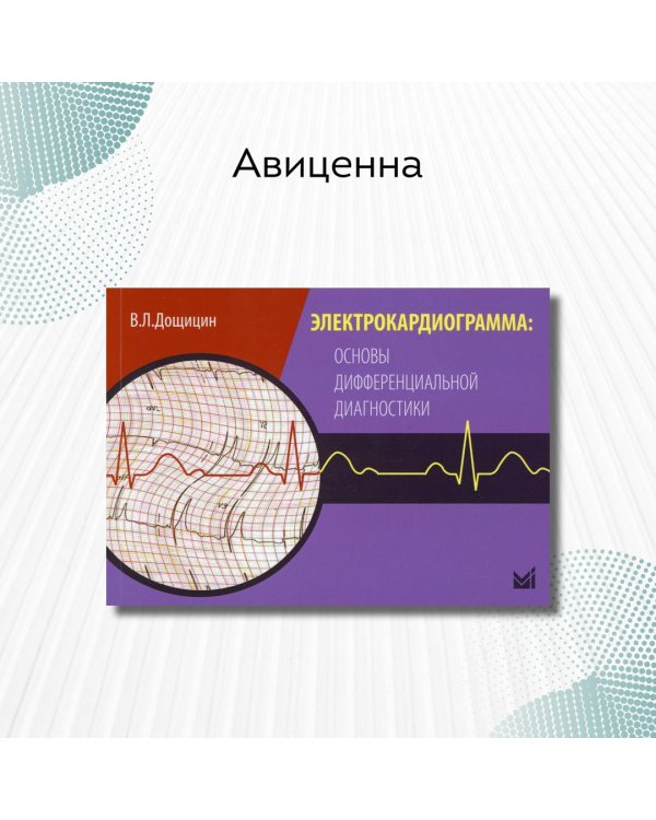 Электрокардиограмма: основы дифференциальной диагностики
