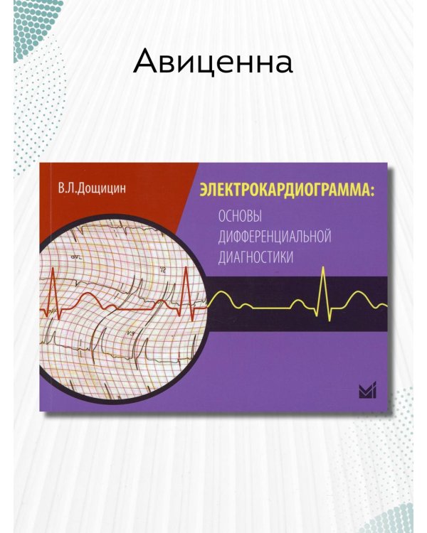 Электрокардиограмма: основы дифференциальной диагностики