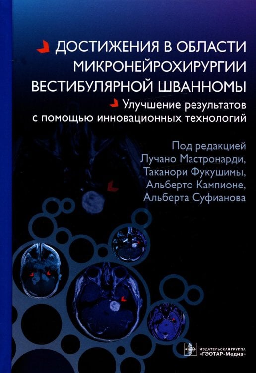 Достижения в области микронейрохирургии вестибулярной шванномы. Улучшение результатов с помощью инновационных технологий