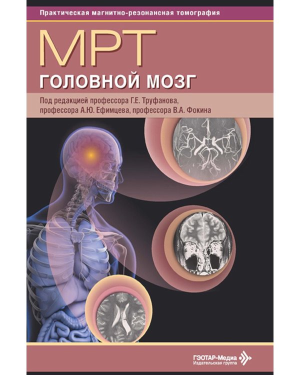 МРТ. Головной мозг: руководство для врачей