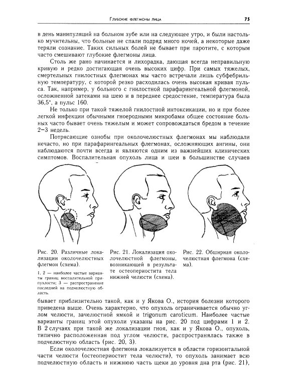Очерки гнойной хирургии. 4-е изд