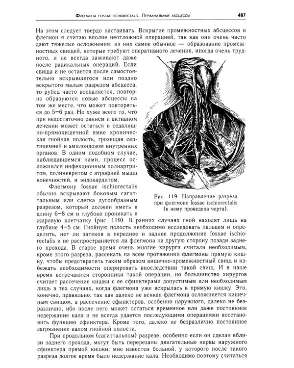Очерки гнойной хирургии. 4-е изд