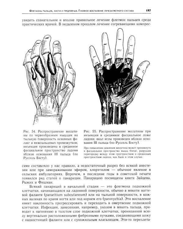 Очерки гнойной хирургии. 4-е изд