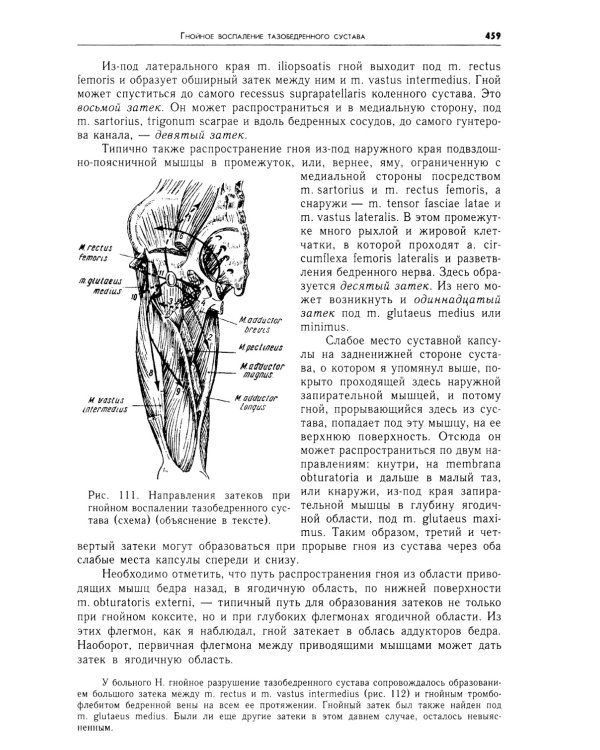 Очерки гнойной хирургии. 4-е изд
