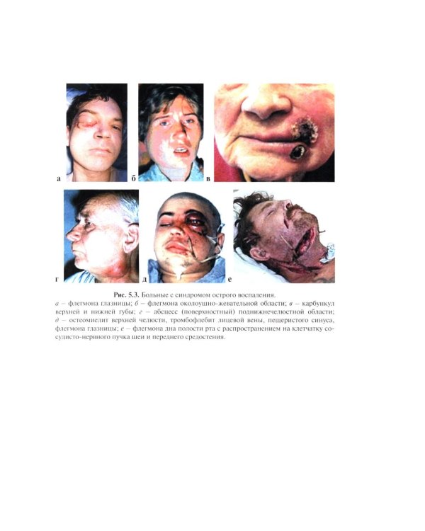 Пропедевтика хирургической стоматологии: Учебное пособие. 7-е изд