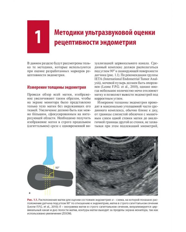 Ультразвуковая оценка рецептивности эндометрия: методические рекомендации. 2-е изд