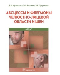 Абсцессы и флегмоны челюстно-лицевой области и шеи. Атлас: учебное пособие