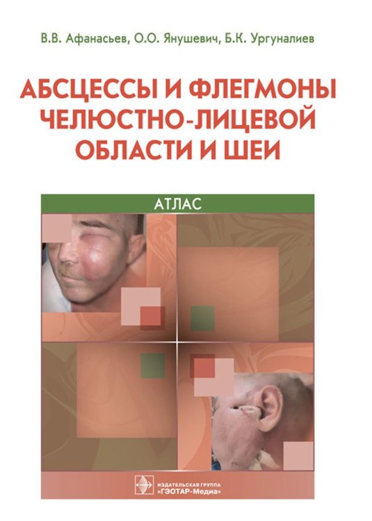 Абсцессы и флегмоны челюстно-лицевой области и шеи. Атлас: учебное пособие
