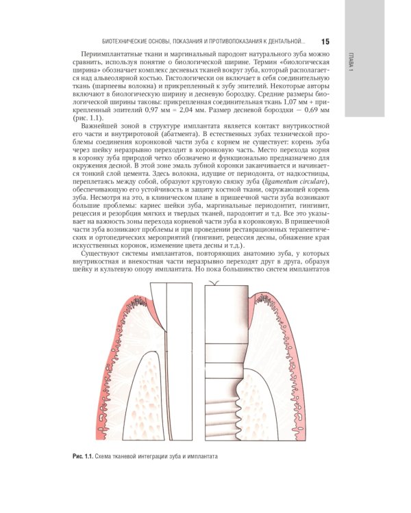 Дентальная имплантация: национальное руководство
