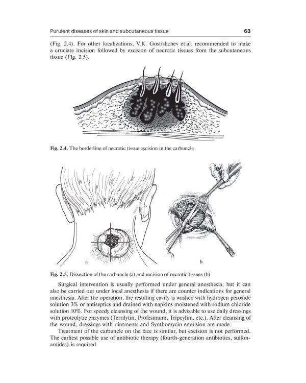 Surgical diseases: textbook. In 2 v. V. 1: на англ.яз