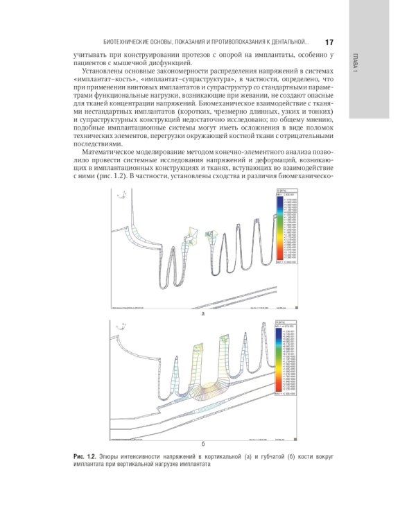 Дентальная имплантация: национальное руководство