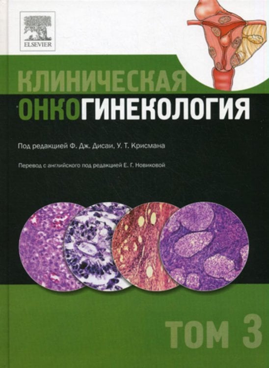 Клиническая онкогинекология. В 3 т. Т. 3 Клиническая онкогинекология. В 3 т. Т. 3