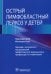 Острый лимфобластный лейкоз у детей
