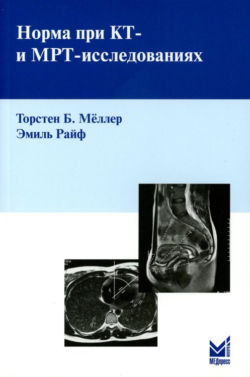 Норма при КТ- и МРТ-исследованиях. 6-е изд Норма при КТ- и МРТ-исследованиях. 6-е изд