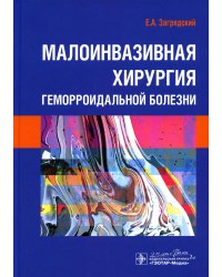 Малоинвазивная хирургия геморроидальной болезни