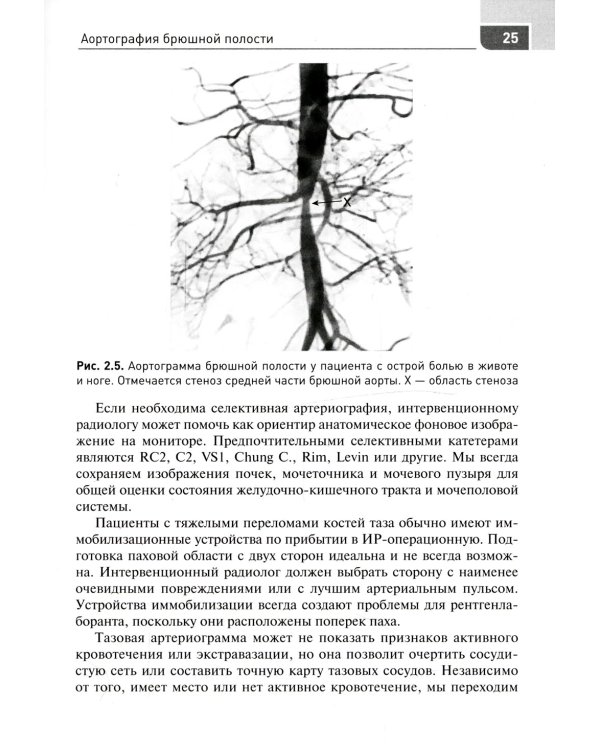 Экстренная и неотложная рентгенхирургия при травматических повреждениях органов и сосудов