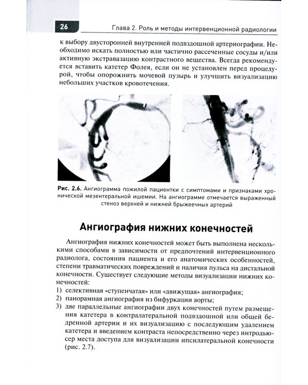 Экстренная и неотложная рентгенхирургия при травматических повреждениях органов и сосудов