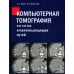 Компьютерная томография печени и желчевыводящих путей: практическое руководство Компьютерная томография печени и желчевыводящих путей: практическое руководство